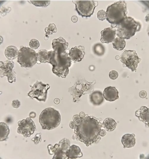 3D spheroids, brightfield